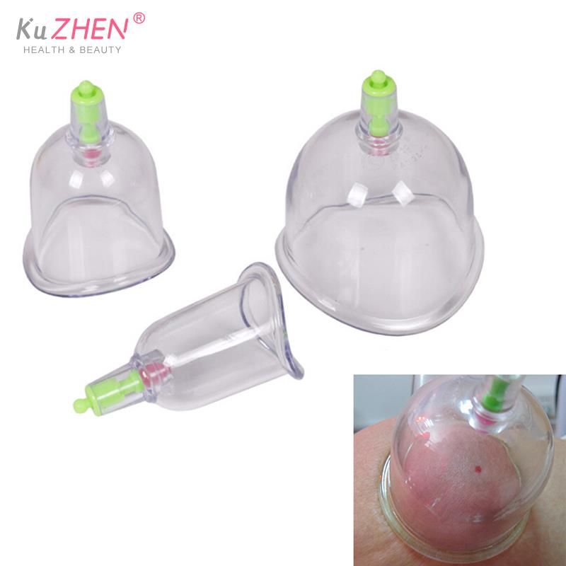 Tradizionale 3 Coppe Kangzhu U - Medical Lab Equipments recensione e prezzo