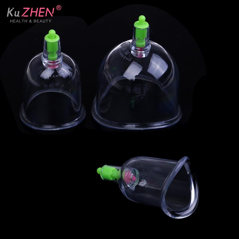 Tradizionale 3 Coppe Kangzhu U - Medical Lab Equipments recensione e prezzo
